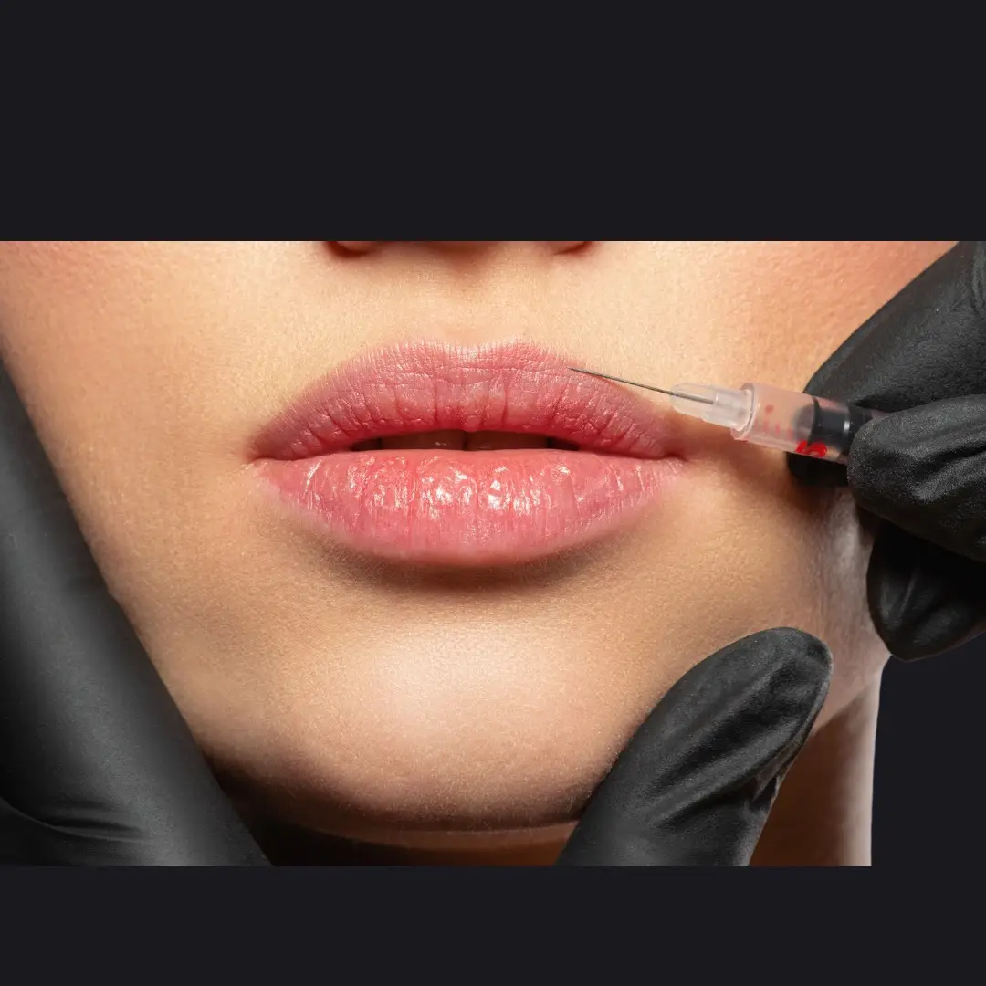 Dermal filler