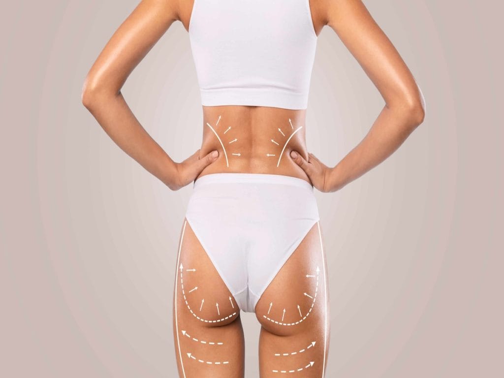 Brazilian Buttock Lift by The Better Body Shop Medspa in Houston TX
