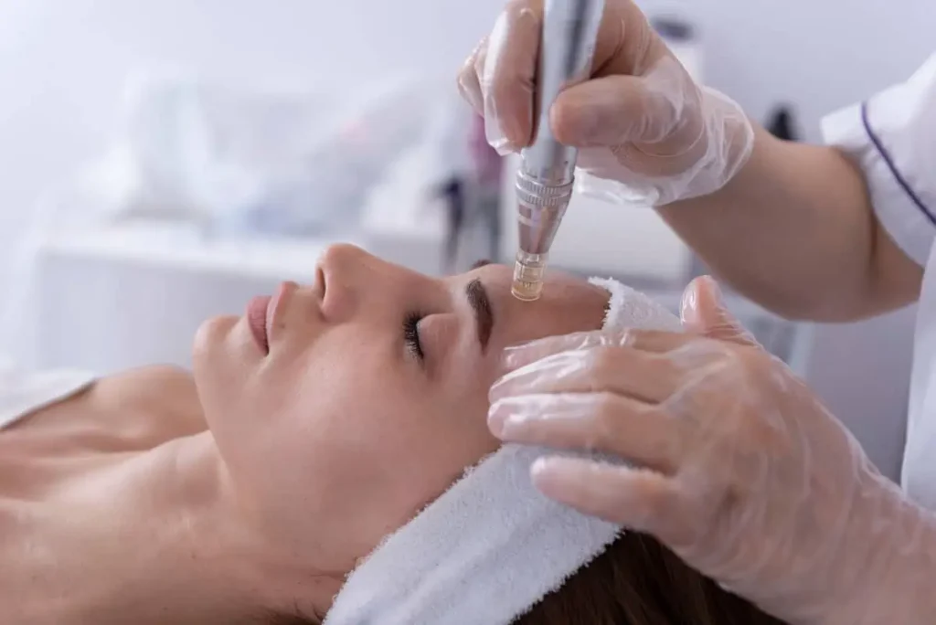 Microneedling Treatment in Houston, TX at The Better Body Shop MedSpa
