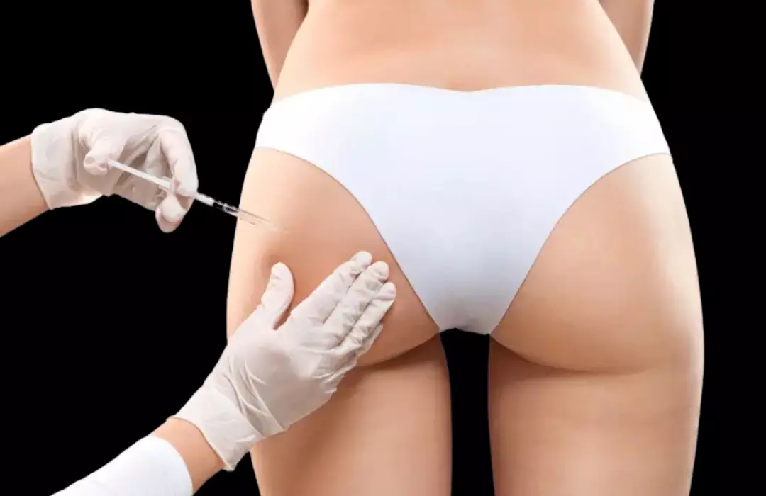 Sculptra BBL injection procedure being performed at The Better Body Shop LLC, Houston, TX, by a professional wearing white gloves.