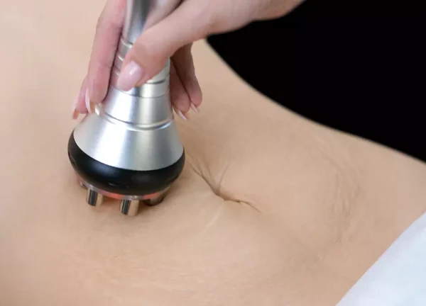 A client’s smooth skin is gently treated with a radiofrequency device, showing natural tightening in action at The Better Body Shop MedSpa in Houston, TX.